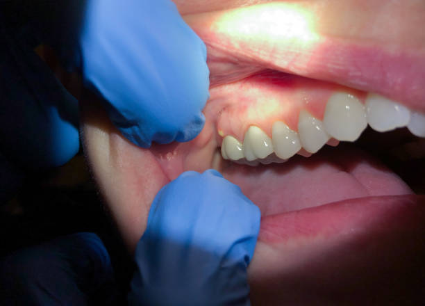 Best Broken Tooth Emergency  in , KS